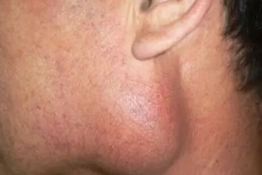 别再挂错号!口腔颌面外科:不止拔智齿,更是“颌面健康守护神”